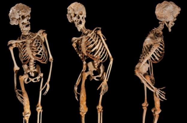 Image via http://www.discoveryuk.com/web/meet-the-elephant-man/photos/