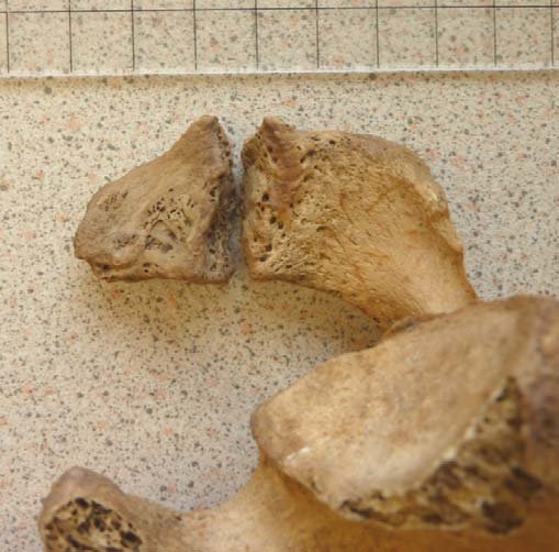 sk4-inferior-view-showing-os-acromiale-of-the-left-scapula-scale-bar-9cm